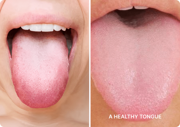 Tongue Health Tongue Health